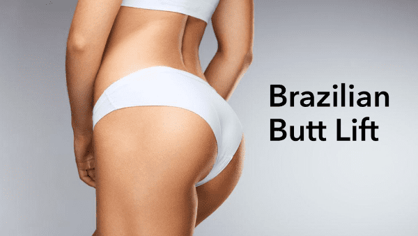 You Need to Know About the Brazilian Butt-Lift (Fat Transfer) Procedure