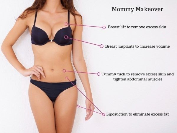 mommymakeover
