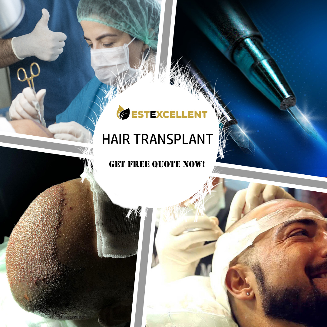 WHAT SHOULD BE CONSIDERED WHEN CHOOSING A HAIR TRANSPLANTATION PLACE?