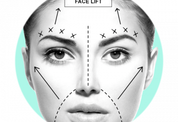 Face & Neck Lift Surgery