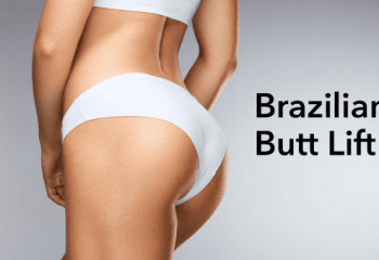 You Need to Know About the Brazilian Butt-Lift (Fat Transfer) Procedure