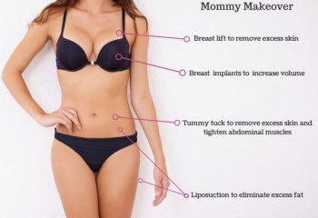 After pregnancy which surgery should I do for better looking (mommy makeover)