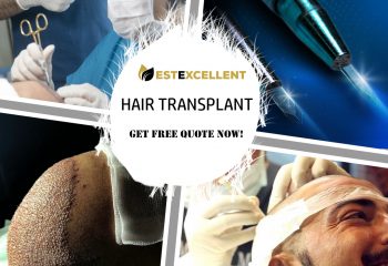 WHAT SHOULD BE CONSIDERED WHEN CHOOSING A HAIR TRANSPLANTATION PLACE?